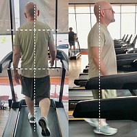Rather than just prescribing exercises, we consistently track your progress in dynamic postural stability using video recordings